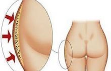 как избавиться от ушек на бедрах