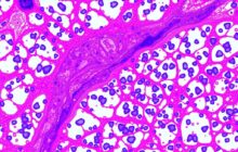 Анализ секрета простаты: что это, как делают и как читать результаты