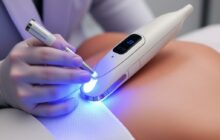 Morpheus8 — когда кожа готова к переменам: подробный гид по микроигольчатому RF-лифтингу